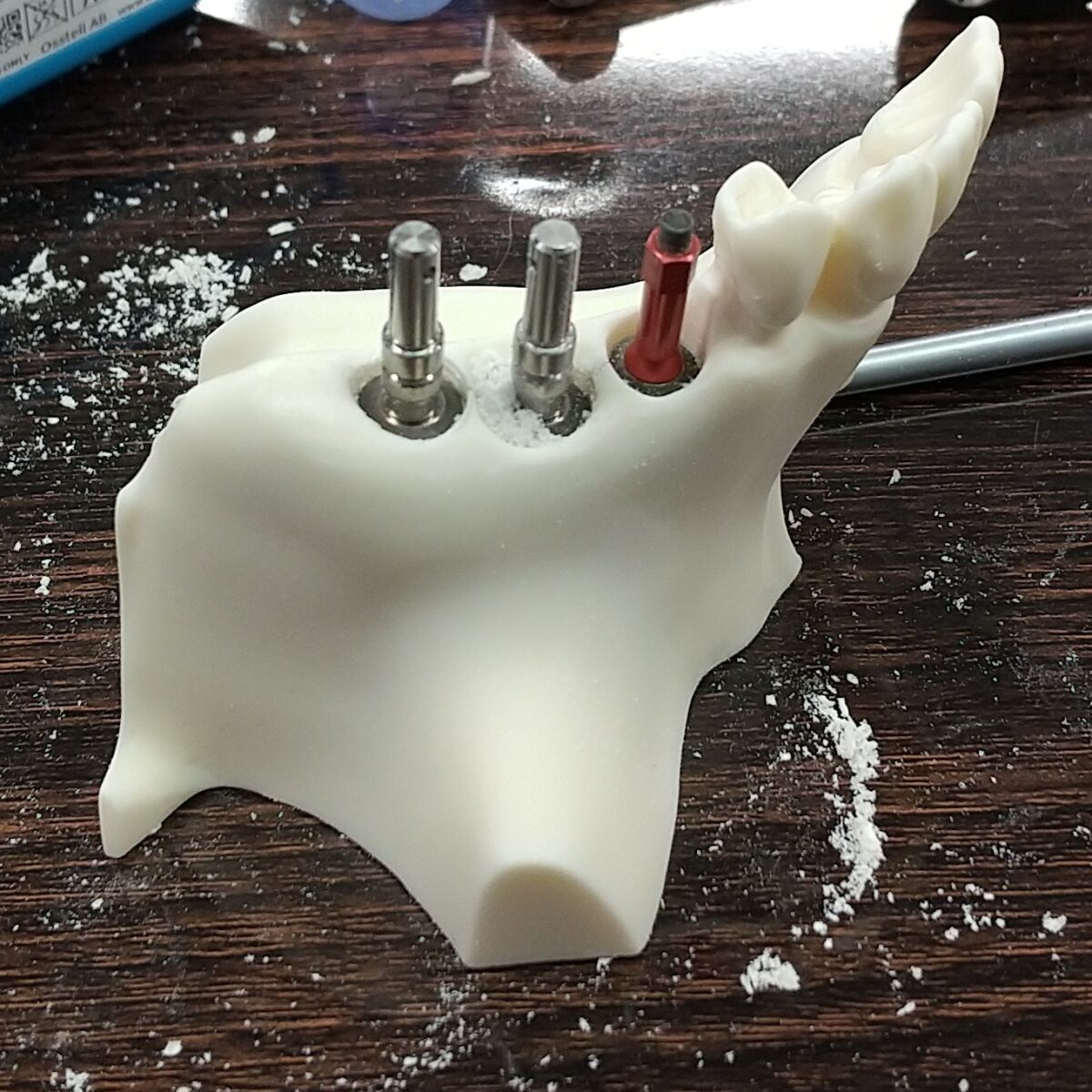 難しいケースのインプラント治療の勉強をしてきました。