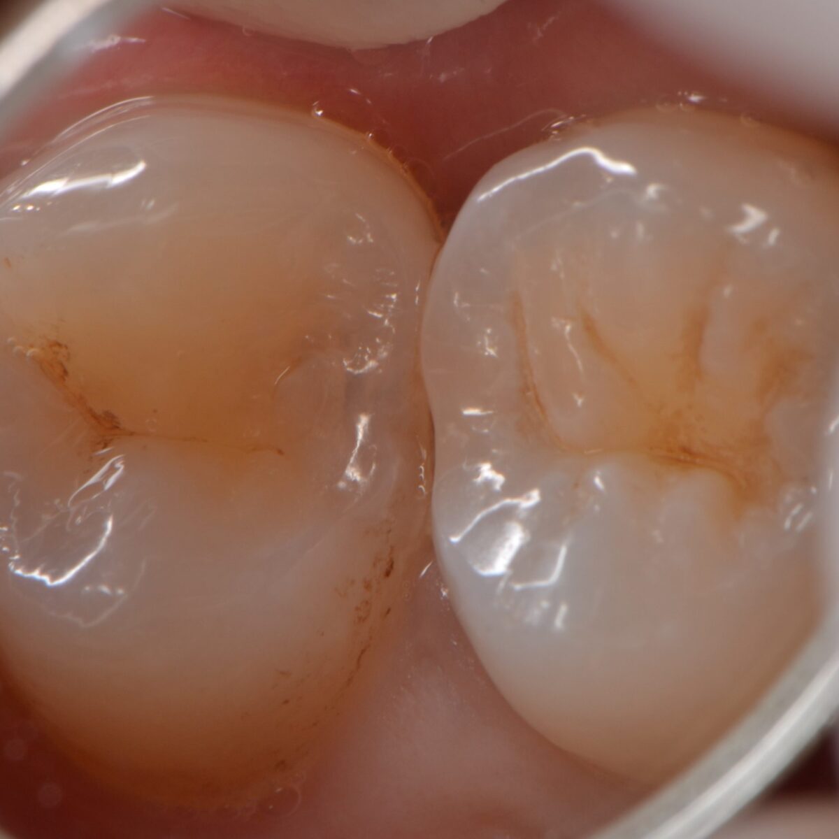 どこにあるのかわかりますか？３