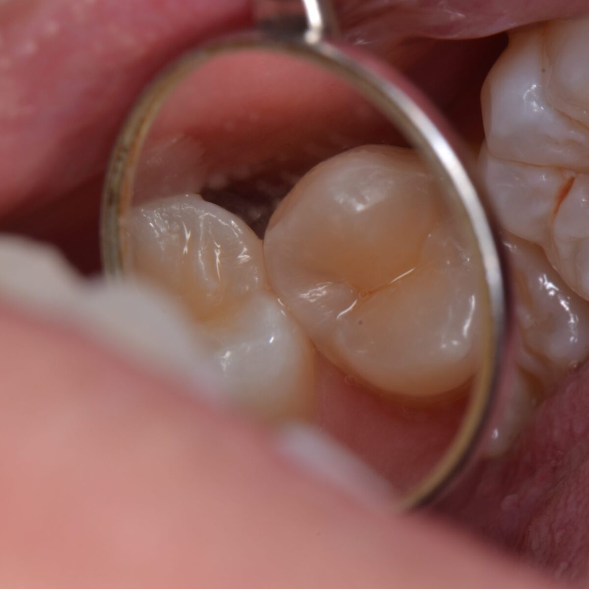 どこにあるのかわかりますか？２