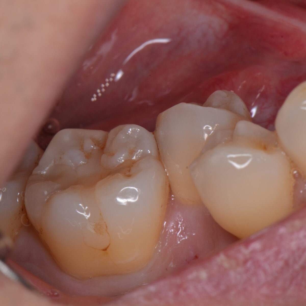 どこにあるのかわかりますか？４