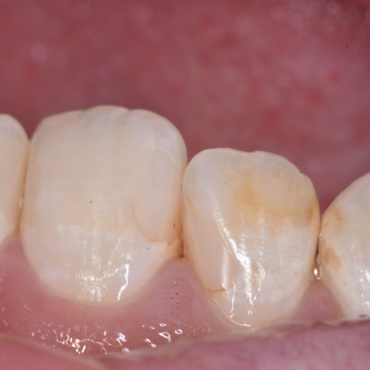 どこになるのかわかりますか?11