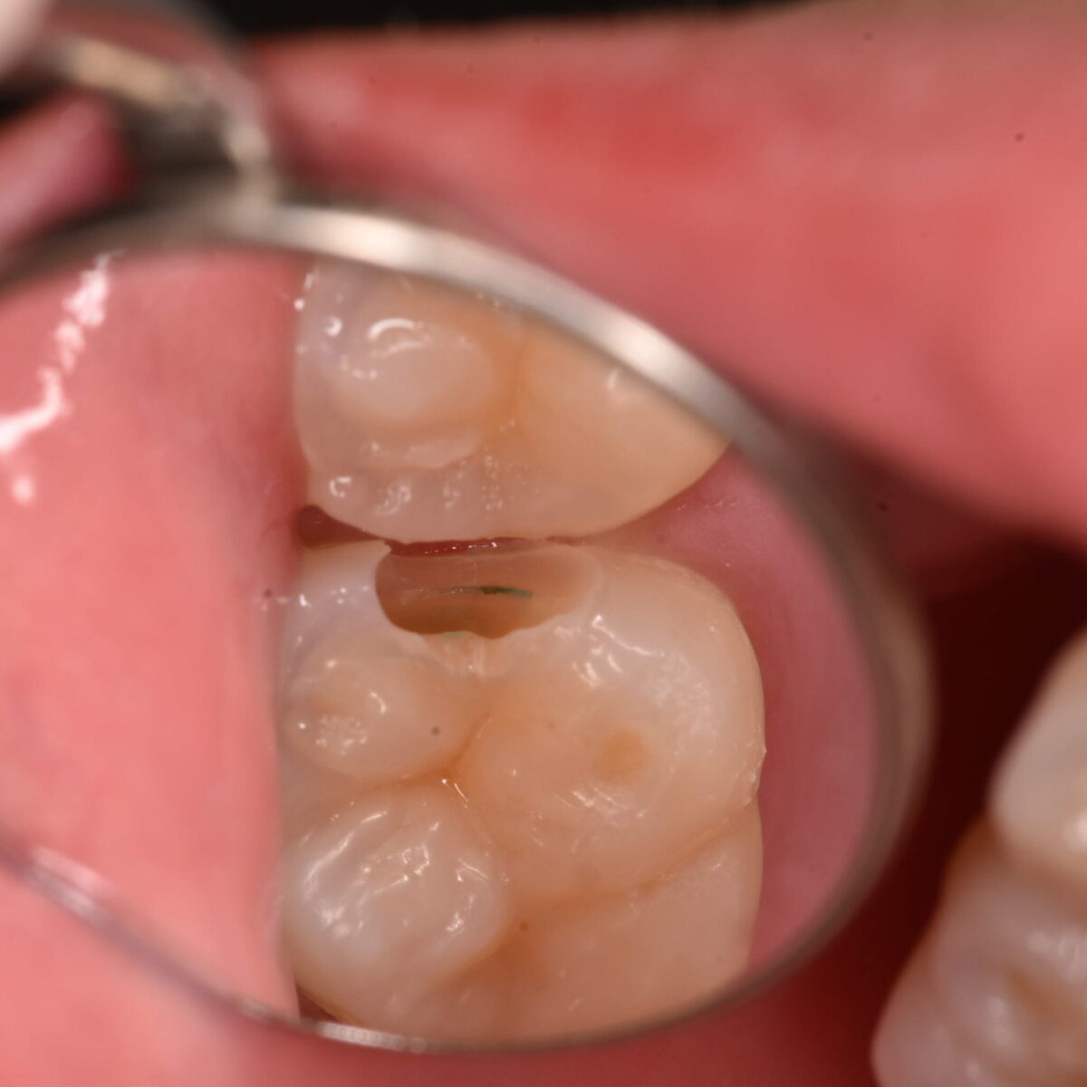 どこにあるのかわかりますか?10