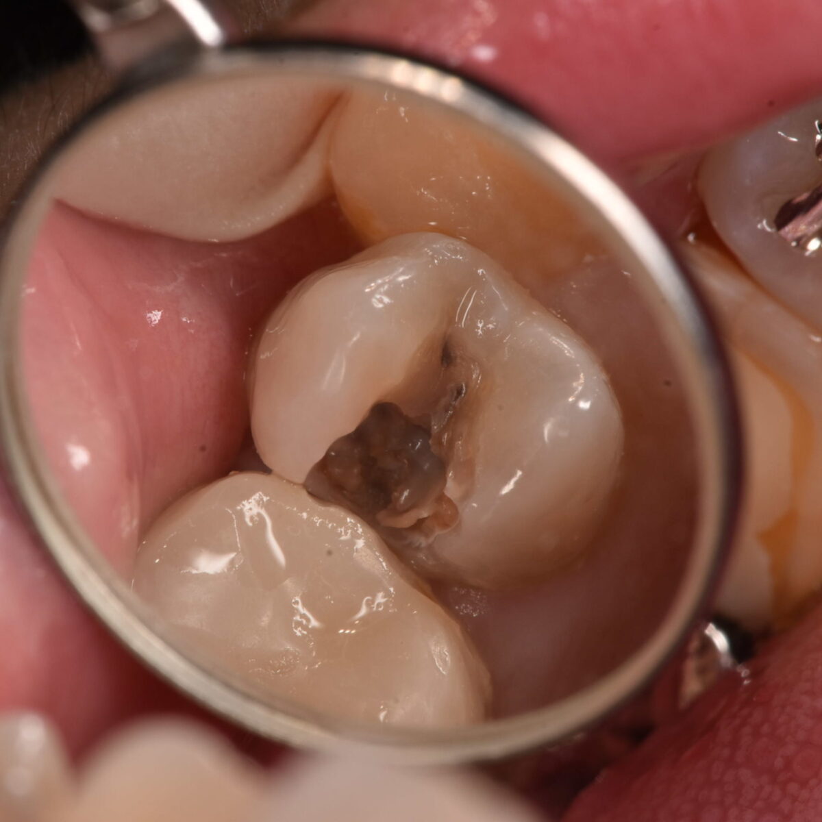 見た目は白くても・・・