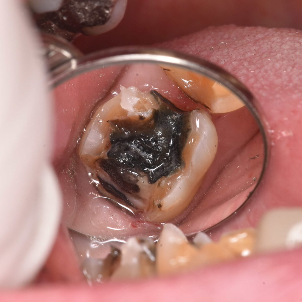 なぜ、治療する時は治し方もこだわるべきなのか？